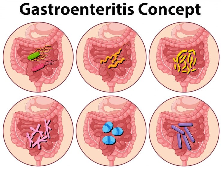 How to Choose the Best Piles Fistula Treatment.